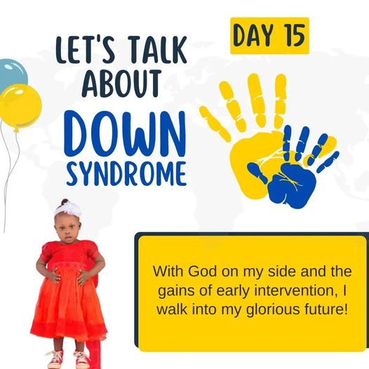 2022 Down syndrome Awareness- Baby Sophie shares her DS Story